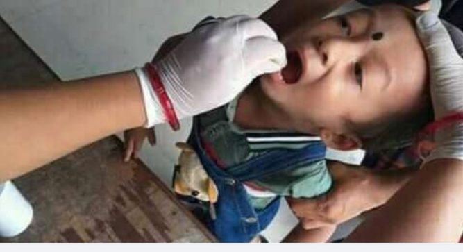 नवलपुरमा ३७ हजार बालबालिकालाई खुवाइयो भिटामिन ए